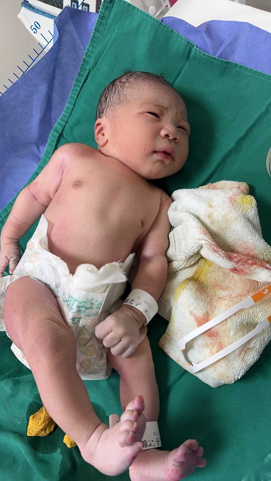 激素紊乱会导致不孕不育吗