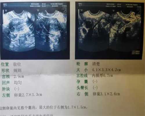 北京代孕公司医院,试管婴儿北京医院排名最好？北京十大医院排名第一？