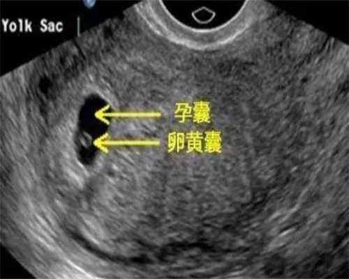 北京权威供卵代孕|科普成都助孕公司试管婴儿移植后注意事项及经验