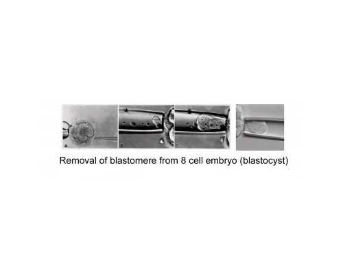 北京失独再生哪家好|北京朝阳医院做供供卵试管费用是多少？