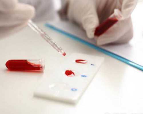 哺乳期急性乳腺炎怎么办，哺乳期急性乳腺炎吃什么药