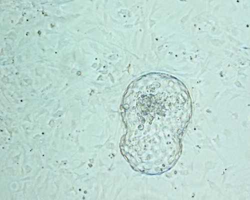 AI技术能优化卵子筛选吗？