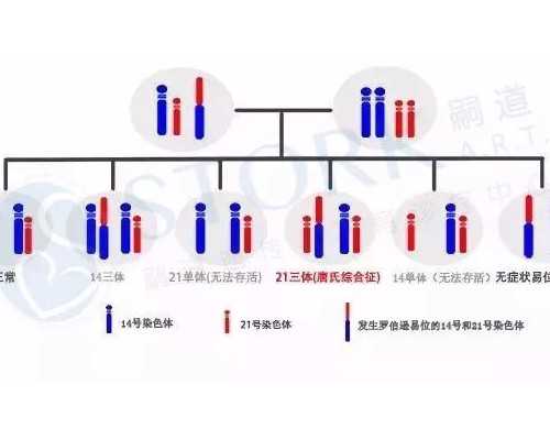 畸形精子会增加胎儿畸形风险吗？