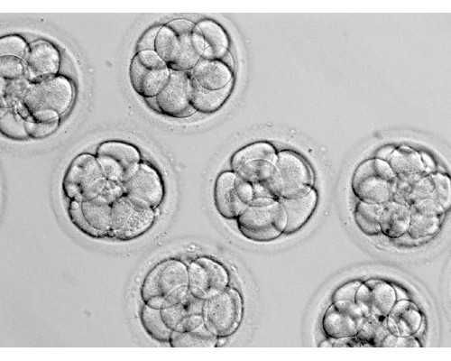 海外试管和国内哪个更好？