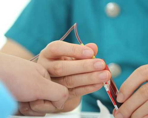 AI技术能优化精子挑选吗？