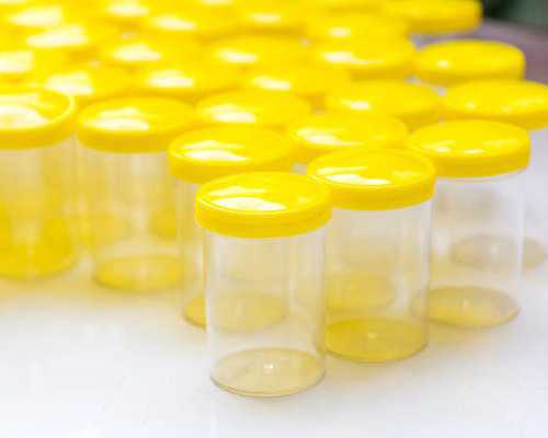 北京正规借卵试管,2024年在北京协和医院做试管婴儿要多少钱？附医院三代试管