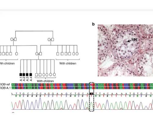多囊卵巢如何提高卵子利用率？