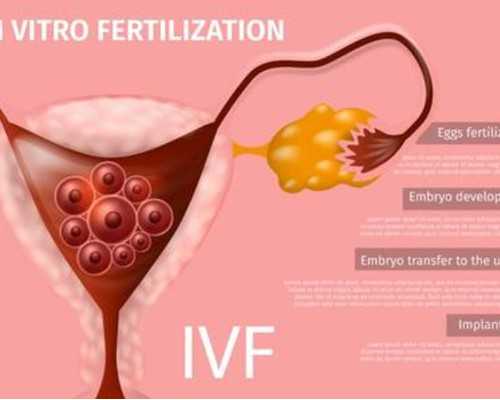 产后如何饮食这五项工作不可少